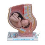 Human baby with (pelvic)